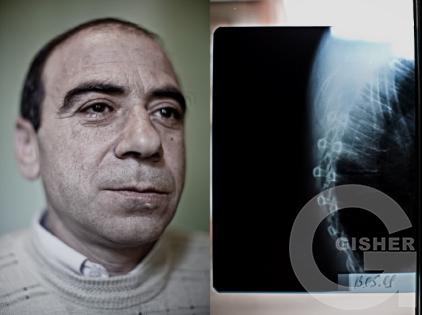 Karen Mirzoyan_Nagorno-Karabakh