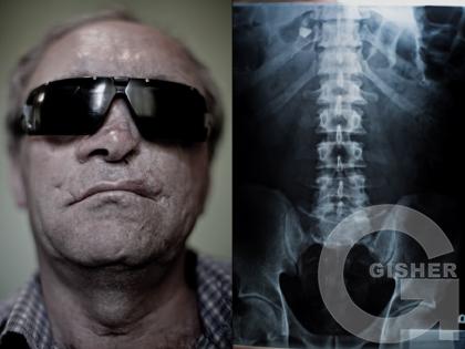 Karen Mirzoyan_Nagorno-Karabakh