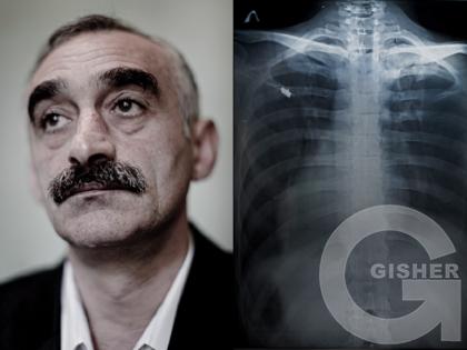 Karen Mirzoyan_Nagorno-Karabakh