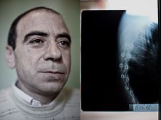 Karen Mirzoyan_Nagorno-Karabakh