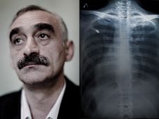 Karen Mirzoyan_Nagorno-Karabakh