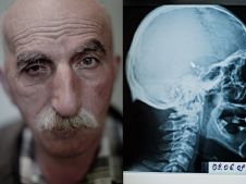 Karen Mirzoyan_Nagorno-Karabakh