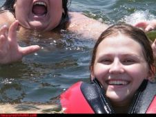 Челюсти в 3D