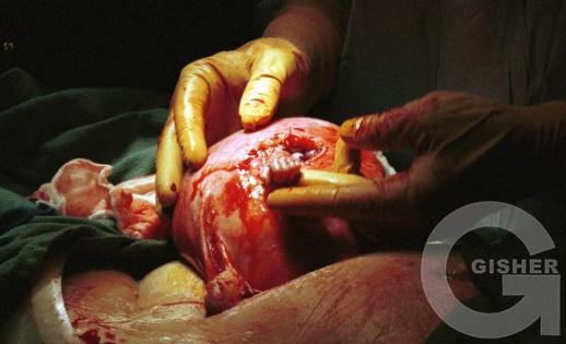 Рука надежды...