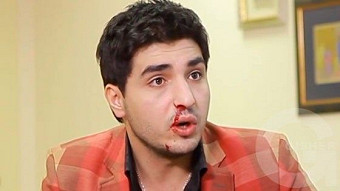 Arajnordnere - Episode 36