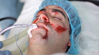 Arajnordnere - Episode 43