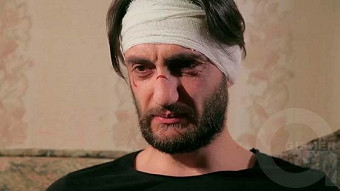 Karmir blur - seria 86